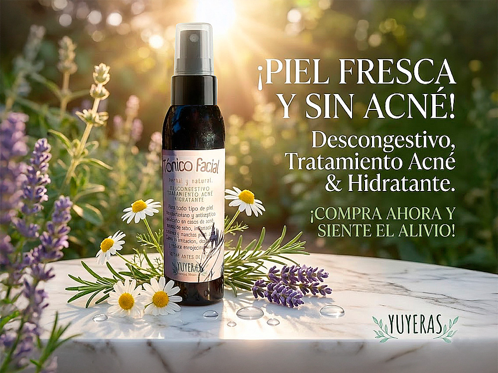 TONICO FACIAL HERBAL Y NATURAL - DESCONGESTIVO, HIDRATANTE Y TRATAMIENTO PARA EL ACNE